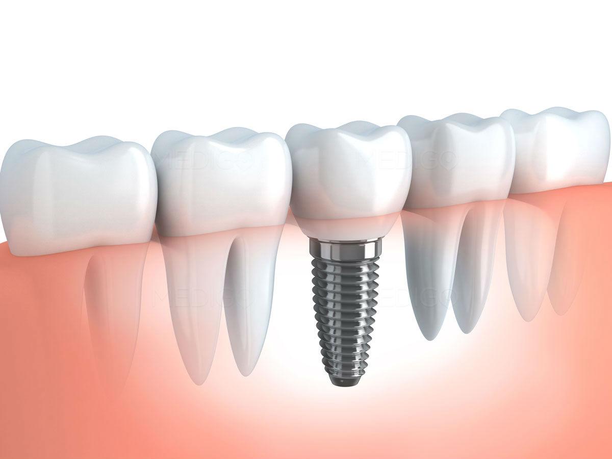 More Tourists Travel to Costa Rica Seeking Quality and Affordable Dental Care